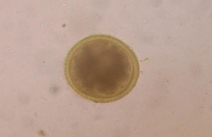 Roundworm egg as seen under the microscope