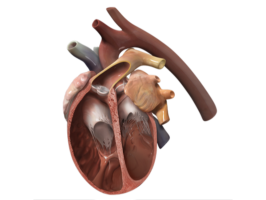 Dilated Cardiomyopathy